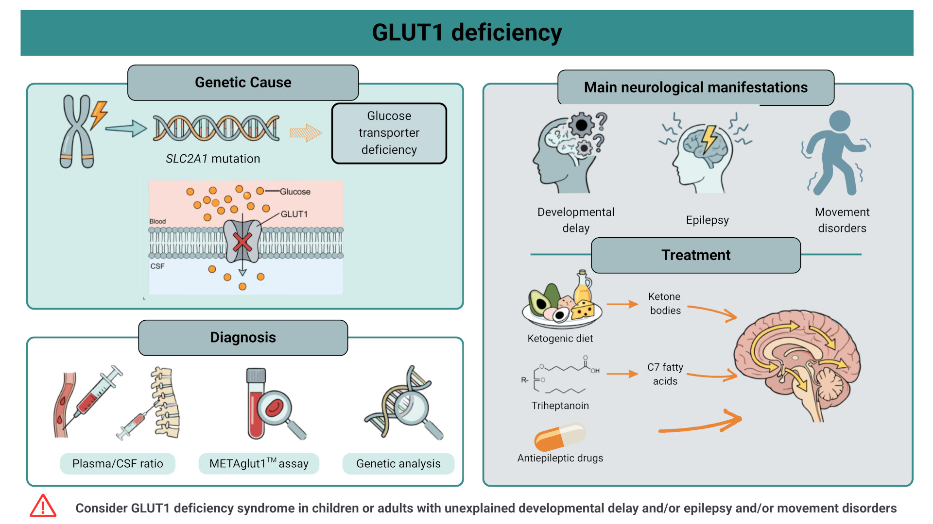 Schéma - Syndrome et deficit en glut1